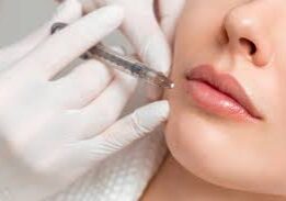 Lip filler injection close up Shawnee KS